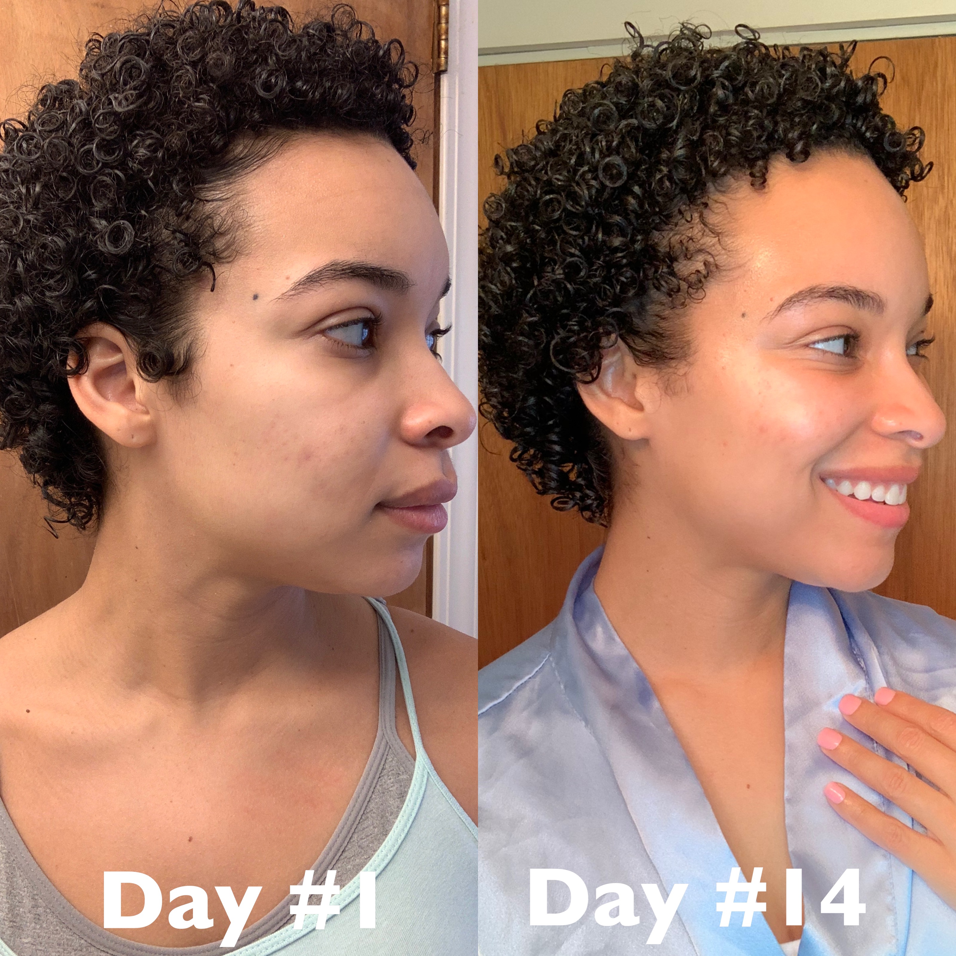 Before and after glowing skin with Palmer's Skin Success collection
