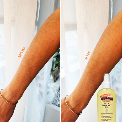 A woman's arm before and after using Palmer's Skin Therapy Oil, one of the best oils for damaged skin.