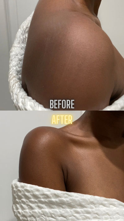 Showing before and after using Palmer's Cocoa Butter Formula Retexture Renew Exfoliating Body Lotion on woman's shoulder